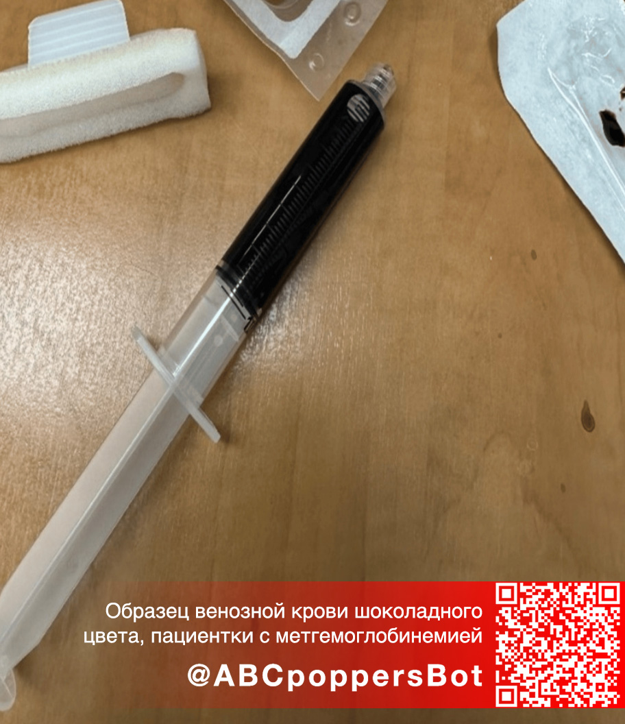 Если принять попперс внутрь в Рязани это вызывает метгемоглобинемию. Смертельное состояние Если принять попперс внутрь в Рязани это вызывает метгемоглобинемию. Смертельное состояние